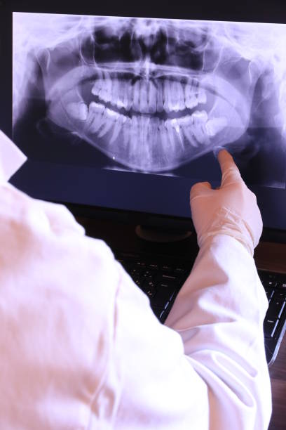 Best Emergency Denture Repair in Aberdeen, WA